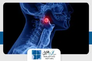 الاورام المجاورة للبلعوم Parapharyngeal Space Tumors