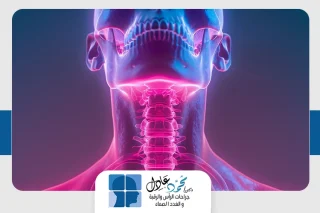 سعر عملية استئصال الغدد الليمفاوية من الرقبة