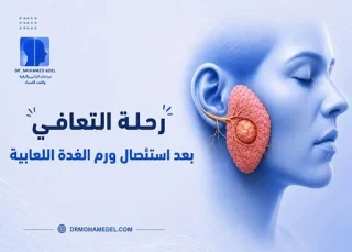 حصوات الغدد اللعابية