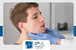 التهاب الغدة النكافية