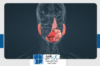 ورم الغدة النكافية